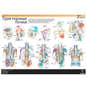 Таблиця триггерних точок + крос тейп